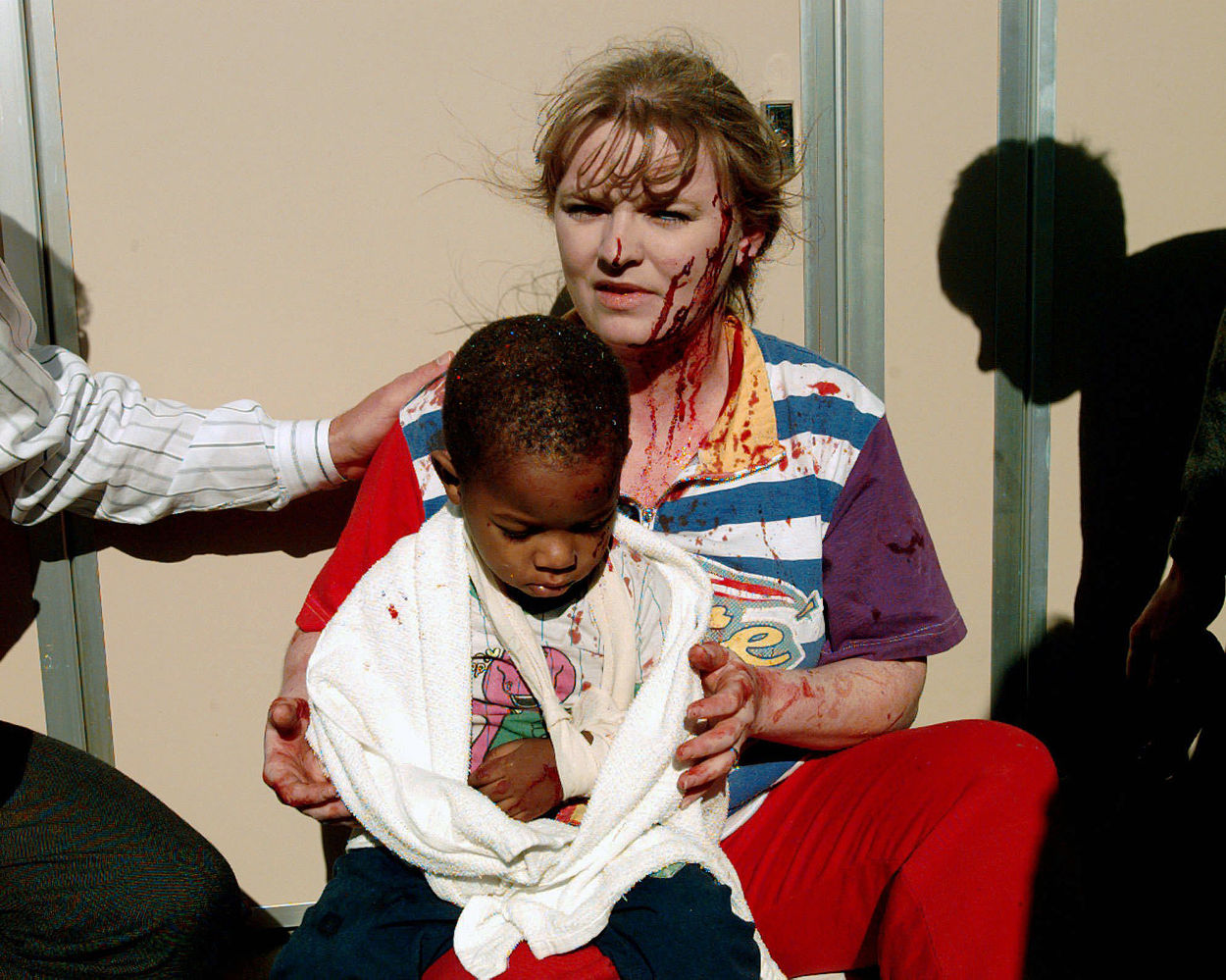 OKC Bombing | The Injured